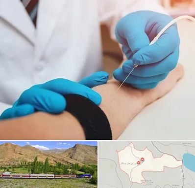 مرکز نوار عصب و عضله در خاش