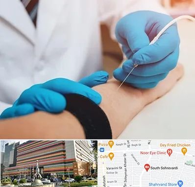 مرکز نوار عصب و عضله در سهروردی 