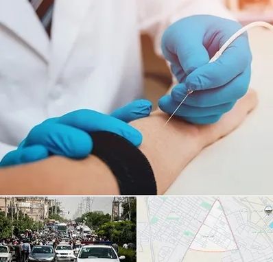 مرکز نوار عصب و عضله در سیدی مشهد