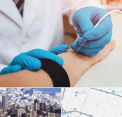 مرکز نوار عصب و عضله در ازگل