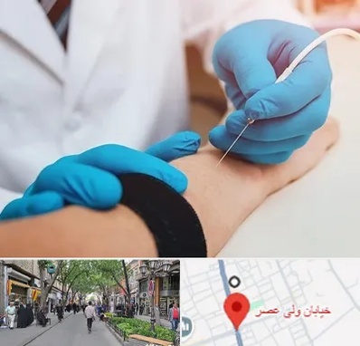 مرکز نوار عصب و عضله در ولیعصر شهریار