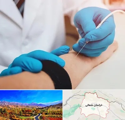 مرکز نوار عصب و عضله در خراسان شمالی