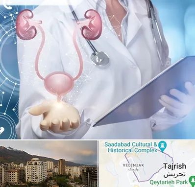 متخصص اورولوژی خانم در زعفرانیه 