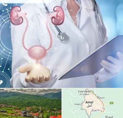 متخصص اورولوژی خانم در آمل
