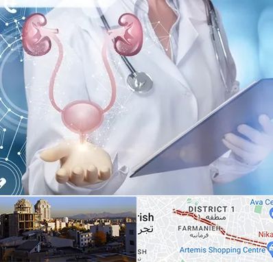 متخصص اورولوژی خانم در فرمانیه 