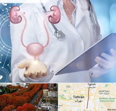 متخصص اورولوژی خانم در ولیعصر 