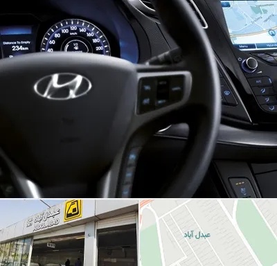 لوازم یدکی هیوندایی در عبدل آباد