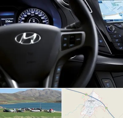 لوازم یدکی هیوندایی در دهگلان