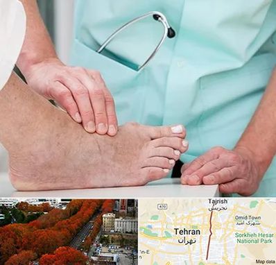 دکتر مفاصل و استخوان در ولیعصر 