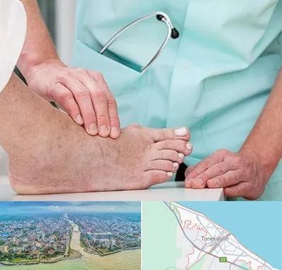 دکتر مفاصل و استخوان در تنکابن