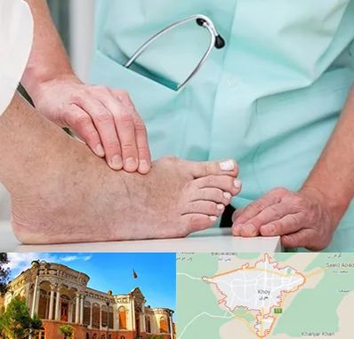 دکتر مفاصل و استخوان در خوی