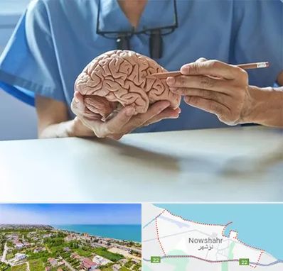 دکتر نورولوژی در نوشهر
