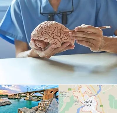دکتر نورولوژی در دزفول