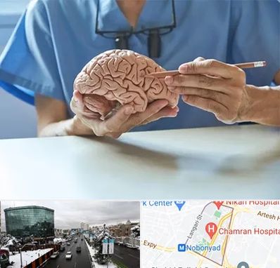 دکتر نورولوژی در اقدسیه 