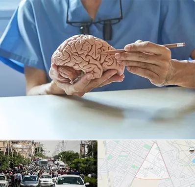 دکتر نورولوژی در سیدی مشهد