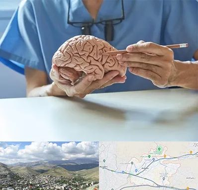 دکتر نورولوژی در رودهن