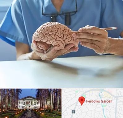 دکتر نورولوژی در باغ فردوس