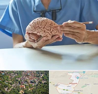 دکتر نورولوژی در دماوند