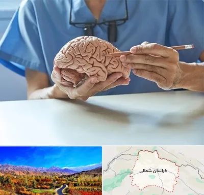 دکتر نورولوژی در خراسان شمالی
