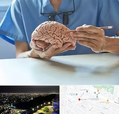 دکتر نورولوژی در هفت تیر مشهد 