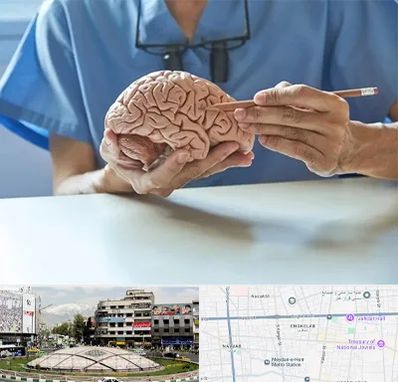 دکتر نورولوژی در مرکز تهران