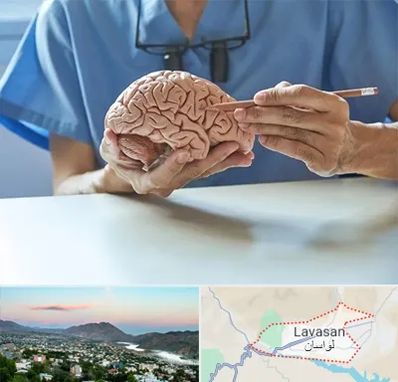 دکتر نورولوژی در لواسان