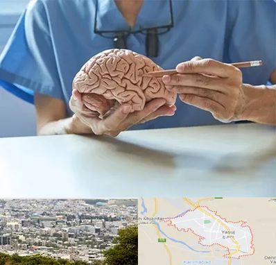 دکتر نورولوژی در یاسوج