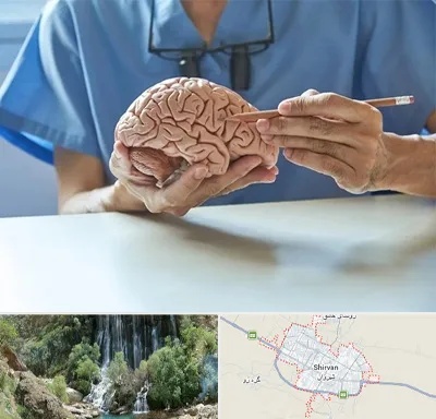 دکتر نورولوژی در شیروان