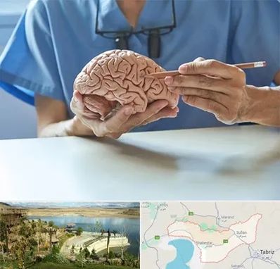 دکتر نورولوژی در شبستر