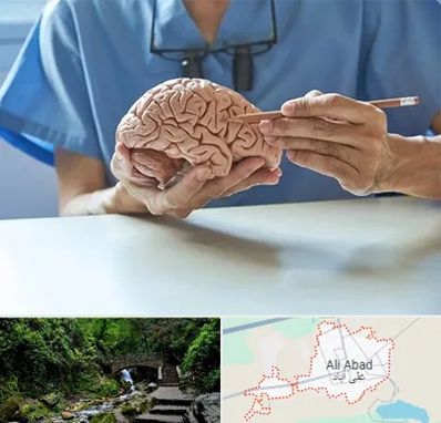 دکتر نورولوژی در علی آباد کتول