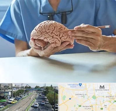 دکتر نورولوژی در جنوب تهران 