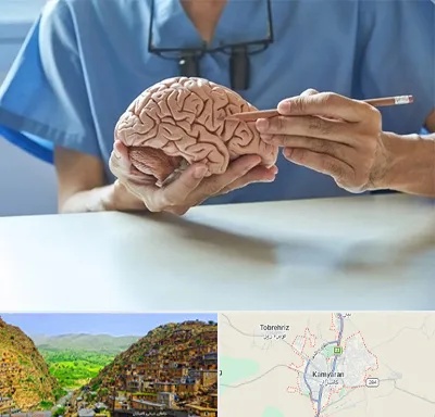 دکتر نورولوژی در کامیاران