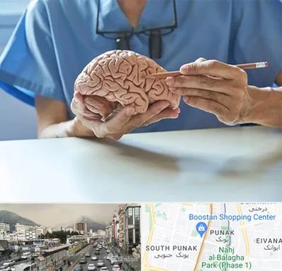 دکتر نورولوژی در پونک 