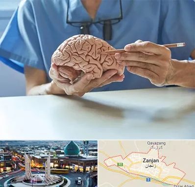 دکتر نورولوژی در زنجان