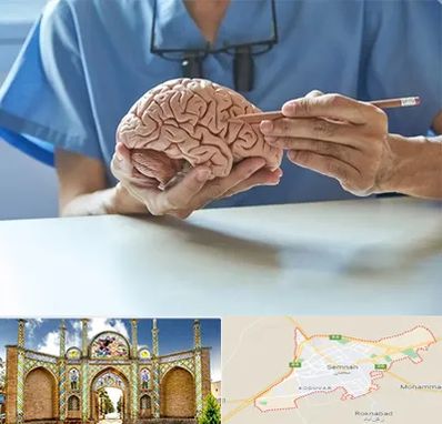 دکتر نورولوژی در سمنان