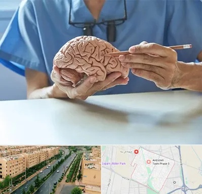 دکتر نورولوژی در فاز سه اندیشه