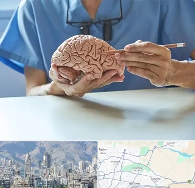 دکتر نورولوژی در شمال شرق تهران