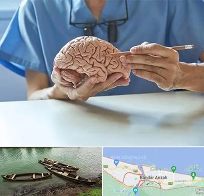 دکتر نورولوژی در بندر انزلی