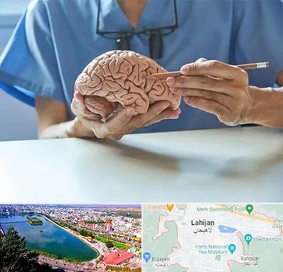 دکتر نورولوژی در لاهیجان