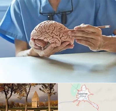 دکتر نورولوژی در تویسرکان