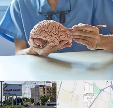 دکتر نورولوژی در فاز یک اندیشه