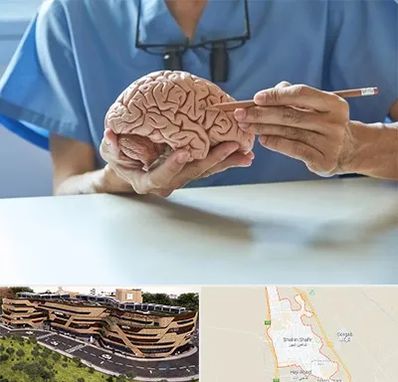 دکتر نورولوژی در شاهین شهر