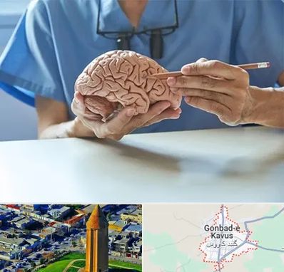 دکتر نورولوژی در گنبد کاووس