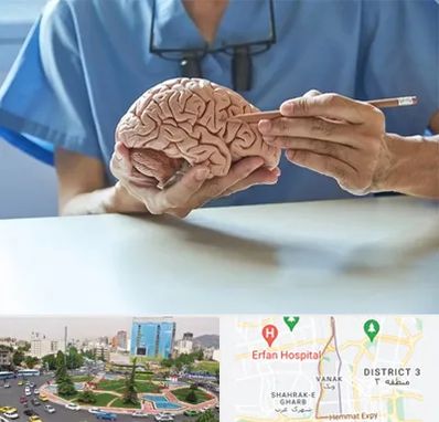 دکتر نورولوژی در ونک 