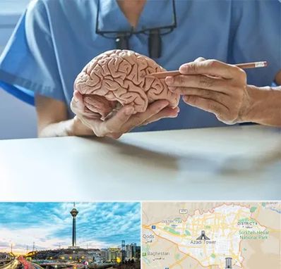 دکتر نورولوژی در تهران