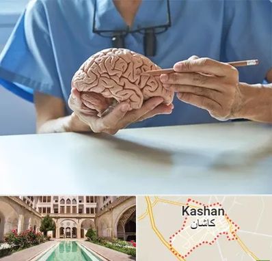دکتر نورولوژی در کاشان