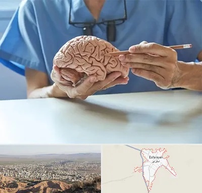 دکتر نورولوژی در اسفراین