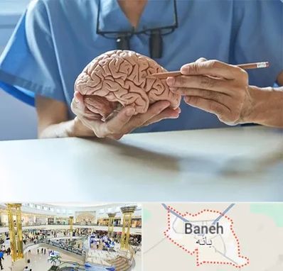 دکتر نورولوژی در بانه