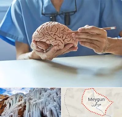 دکتر نورولوژی در میگون