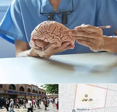 دکتر نورولوژی در بازار تهران